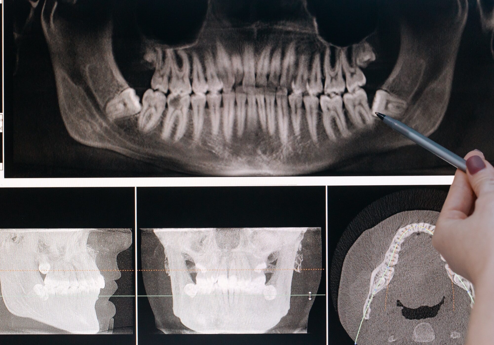 dental xray ravenna dentist